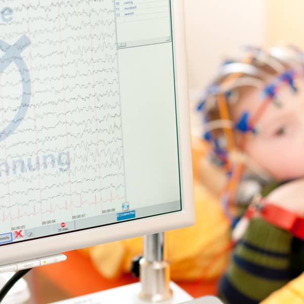 Ausbildungsoffensive: Neue DGKN-Ausbildung in pädiatrischer Neurophysiologie